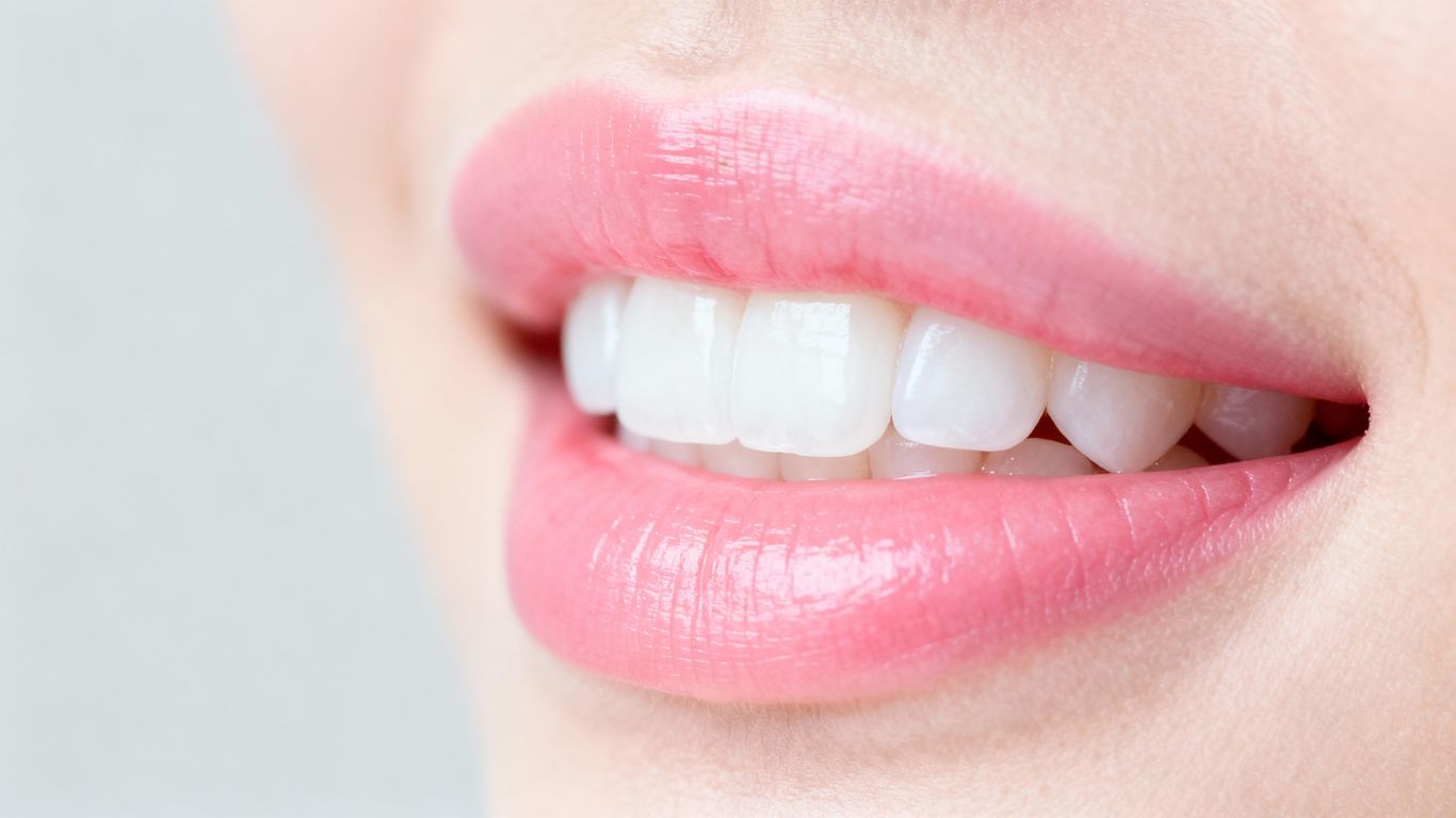 Gingivitis? Let’s Talk Gums!
